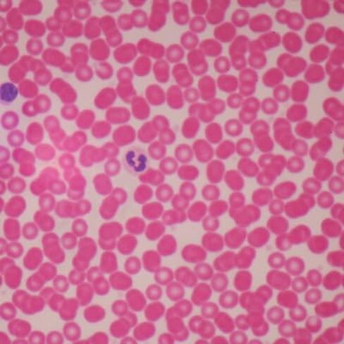 Human Male Blood Film Slide, Smear in Saudi Arabia
