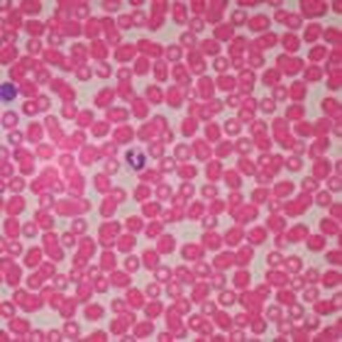 Human Male Blood Film Slide, Smear in Saudi Arabia