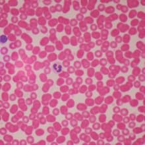 Human Male Blood Film Slide, Smear in Saudi Arabia