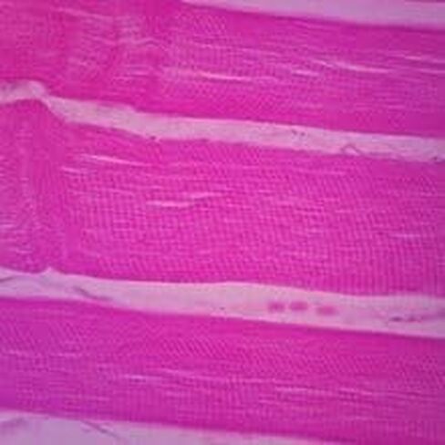 شريحة العضلات الهيكلية البشرية البالغة، 7 ميكرومتر؛ هو in Kuwait