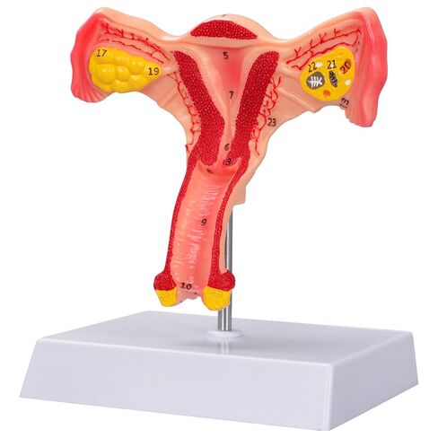 SimCoach Human Uterus and Ovary Anatomical Model, Female Reproductive Model for Medical Education, Gynecological Teaching Tool for Science Classroom & Training Demonstrations in Kuwait