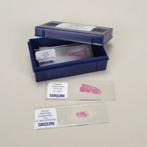 Human Lung Pathology Microscope Slide Set in Kuwait