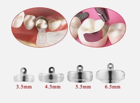 Dental Sectional Matrices with Holes 50/Pack - 3.5mm Sectional Dental Matrix System Contoured Metal Matrices (4.5) in Saudi Arabia