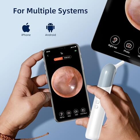 كاميرا الأذن اللاسلكية من كيميك - منظار الأذن واي فاي 1080 بيكسل مع 6 مصابيح LED، وكاميرا نطاق الأذن مع 10 ملحقات ملونة للأطفال والحيوانات الأليفة والكبار، تدعم الصور والفيديو، متوافقة مع أندرويد in Kuwait