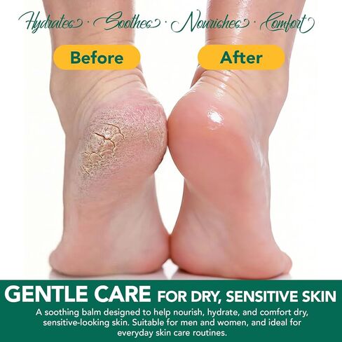 Tea Tree Oil Balm, Tea Tree Oil for Skin, Soothing Balm with Eucalyptus, Aloe, Lavender & Calendula, Soothes Dry, Itchy Skin on Feet, Body & Common Irritated Areas, Intense Moisturizer in Kuwait