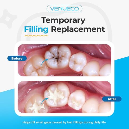 Zinc Oxide Eugenol Cement Dental Care Kit Glue for Crowns & Bridges Filling in Saudi Arabia