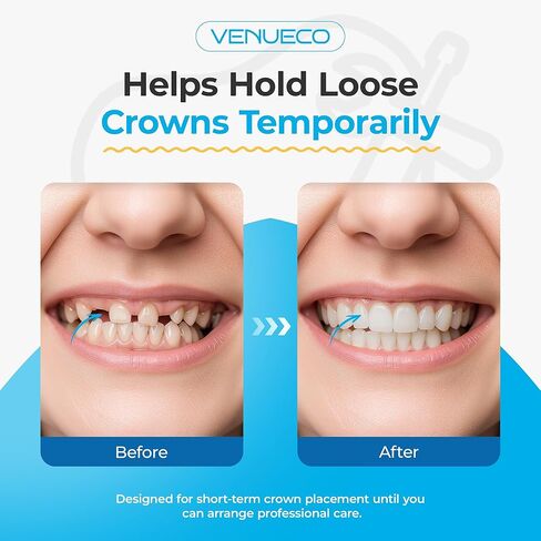 Zinc Oxide Eugenol Cement Dental Care Kit Glue for Crowns & Bridges Filling in Saudi Arabia