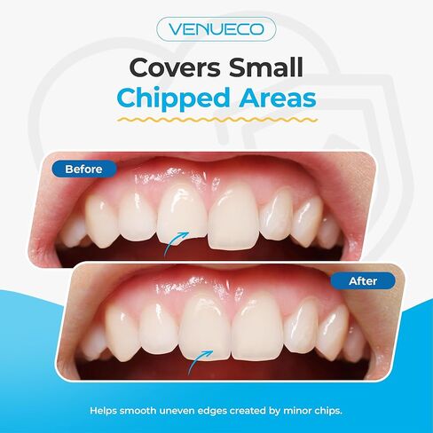 Zinc Oxide Eugenol Cement Dental Care Kit Glue for Crowns & Bridges Filling in Saudi Arabia