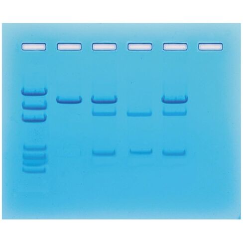Cancer Gene Detection,Group Size for 8 Gels in Saudi Arabia