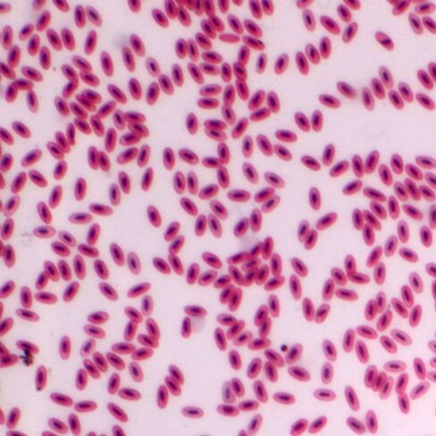 Bird Blood Film, Smear Microscope Slide in Kuwait
