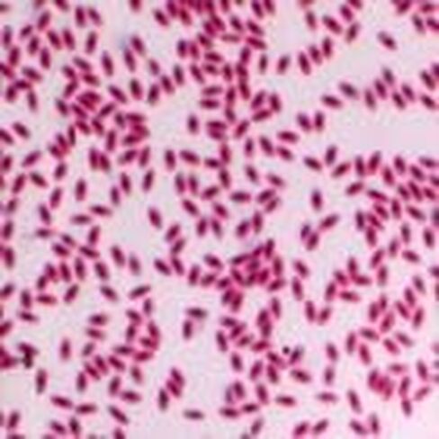 Bird Blood Film, Smear Microscope Slide in Kuwait
