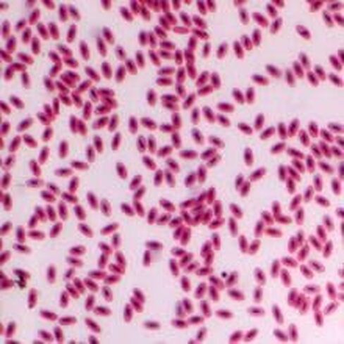 Bird Blood Film, Smear Microscope Slide in Kuwait