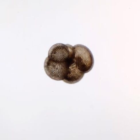 Foraminifera Slide, w.m. in Kuwait