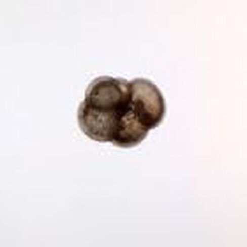 Foraminifera Slide, w.m. in Kuwait