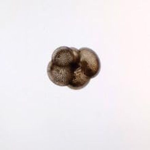 Foraminifera Slide, w.m. in Kuwait