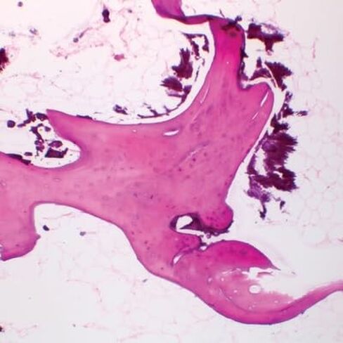 Human Spongy Bone, sec. 7 µm H&E Microscope Slide in Saudi Arabia