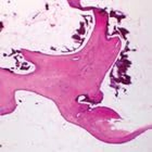 Human Spongy Bone, sec. 7 µm H&E Microscope Slide in Saudi Arabia