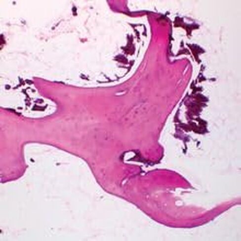 Human Spongy Bone, sec. 7 µm H&E Microscope Slide in Saudi Arabia
