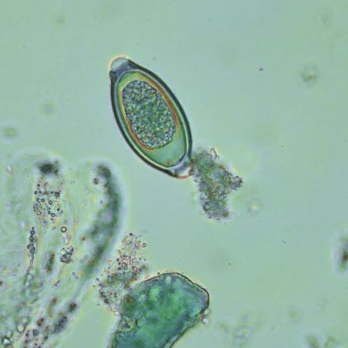 Fecal Egg Count Slide, McMaster Parasite Egg Slide,Worm Egg Count for Veterinary use. Livestock Parasite Management. FEC and FECRT Reference Guide Glass Material is not Easy to Become turbid in Saudi Arabia