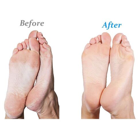 بكرات إعادة التعبئة المتوافقة مع تقنية SoftFLEX من Emjoi Micro-Pedi (خشنة جدًا) - عبوة من 4 قطع in Kuwait