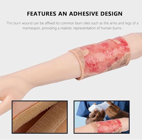 نموذج محاكاة لجروح الحروق، نموذج تدريب على حرق الأطراف بدرجة 2-3، وسادة عرض لإصابات الحروق يمكن ارتداؤها، قابلة لإعادة الاستخدام، تصميم ذو مظهر واقعي، لعرض التعليم الطبي in Kuwait