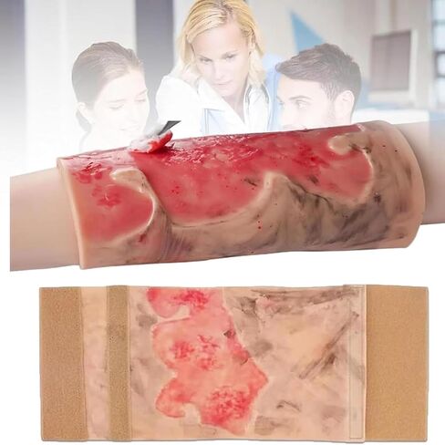 Simulated Burn Wound Model, 2-3 Degree Limb Burns Training Module, Wearable + Reusable, for Care, Medical Teaching Demonstration, for Education in Kuwait