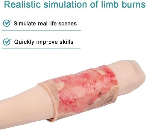 Simulated Burn Wound Model, 2-3 Degree Limb Burns Training Module, Wearable + Reusable, for Care, Medical Teaching Demonstration, for Education in Kuwait