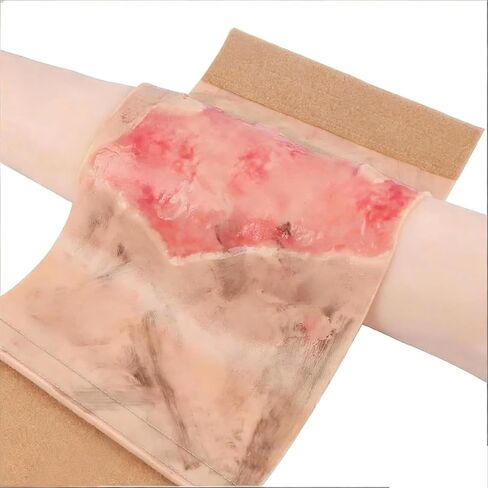 Simulated Burn Wound Model, 2-3 Degree Limb Burns Training Module, Wearable + Reusable, for Care, Medical Teaching Demonstration, for Education in Kuwait