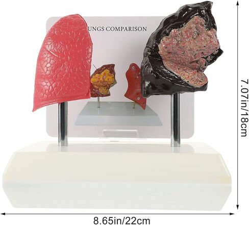 PartyKindom Smoking and Normal Lung Comparison Model, Medical Teaching Tool for Students Educators, Accurate Anatomy Display Model Demonstrating Lung Health Pathological Features in Saudi Arabia