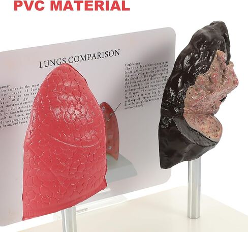 PartyKindom Smoking and Normal Lung Comparison Model, Medical Teaching Tool for Students Educators, Accurate Anatomy Display Model Demonstrating Lung Health Pathological Features in Saudi Arabia
