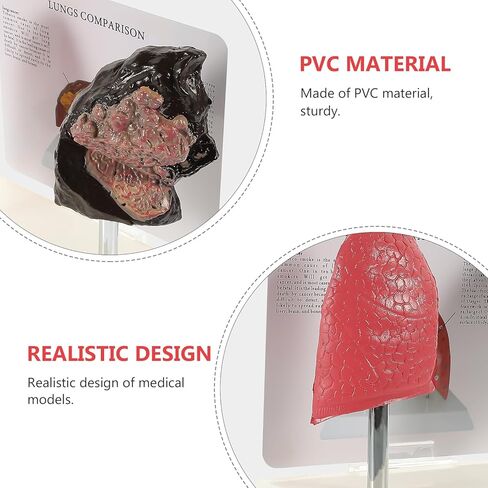PartyKindom Smoking and Normal Lung Comparison Model, Medical Teaching Tool for Students Educators, Accurate Anatomy Display Model Demonstrating Lung Health Pathological Features in Saudi Arabia