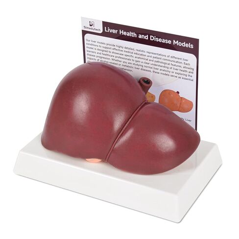 Healthy Liver Anatomy Model, Life-Size Silicone Human Liver Replica for Medical Training, Nursing Education, and Patient Demonstration in Kuwait