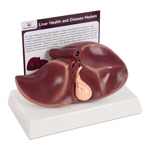 Healthy Liver Anatomy Model, Life-Size Silicone Human Liver Replica for Medical Training, Nursing Education, and Patient Demonstration in Kuwait
