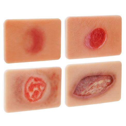 PER4MANCE Pressure Ulcer Wound Model Stages I–IV: Silicone Decubitus Care Training Kit for Nursing Practice & Medical Education in Kuwait