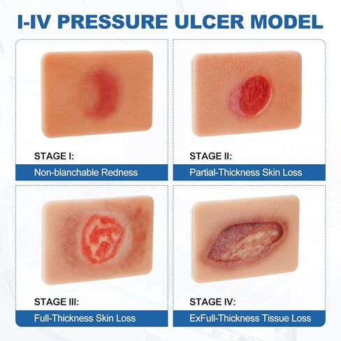 PER4MANCE Pressure Ulcer Wound Model Stages I–IV: Silicone Decubitus Care Training Kit for Nursing Practice & Medical Education in Kuwait