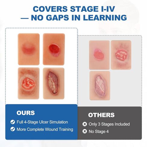 PER4MANCE Pressure Ulcer Wound Model Stages I–IV: Silicone Decubitus Care Training Kit for Nursing Practice & Medical Education in Kuwait