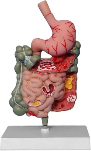 Human Digestive System Model Stomach Section PVC Sturdy Scientific Stomach Model Classroom Science Study Display in Kuwait