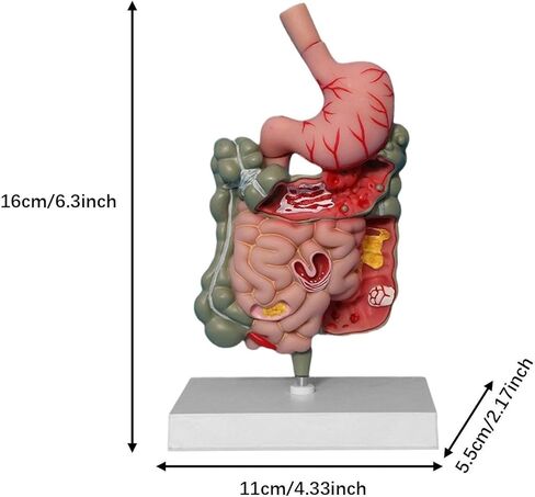 Human Digestive System Model Stomach Section PVC Sturdy Scientific Stomach Model Classroom Science Study Display in Kuwait