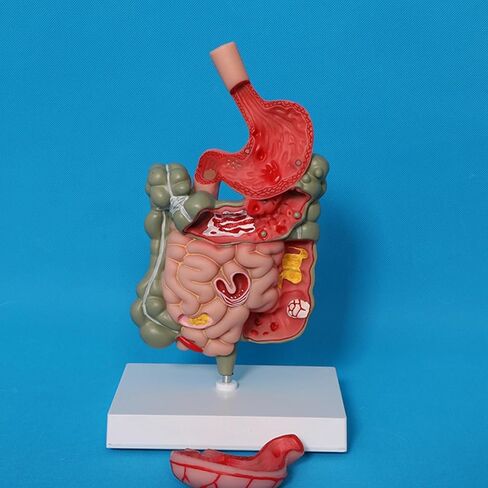 Human Digestive System Model Stomach Section PVC Sturdy Scientific Stomach Model Classroom Science Study Display in Kuwait