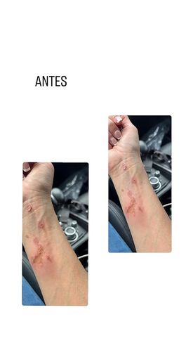 Angely's Beauty مسحوق عضوي Tepezcohuite in Kuwait