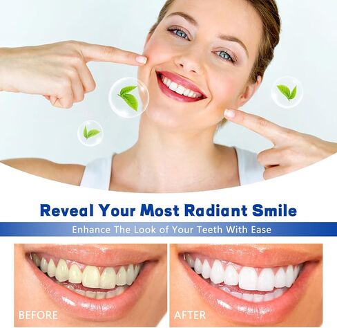 SmileFitPro Tooth Polish, Tooth Whitening Paint - Instant White Teeth, Gentle & Safe Formula, Simple & Portable White Paint for Teeth - Regain Confident Smile(2pcs in Kuwait