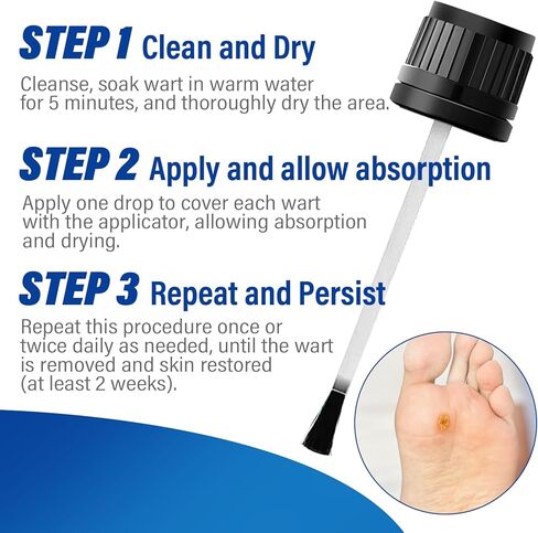 سائل مزيل الثآليل بقوة إضافية مع حمض الساليسيليك بنسبة 17%، علاج سريع المفعول للثآليل الأخمصية والشائعة، مزيل الذرة للقدمين وأصابع القدم 15 مل in Kuwait