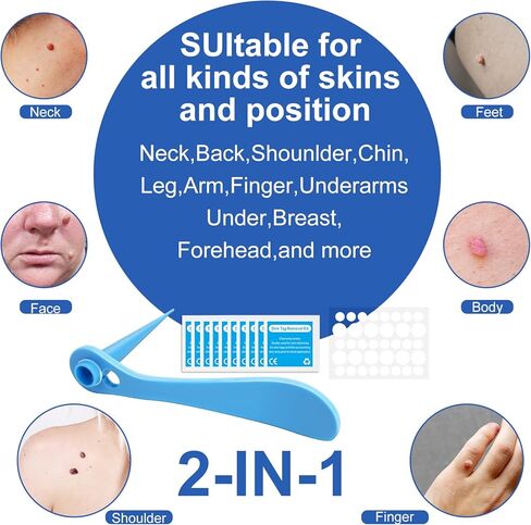 جهاز إزالة الزوائد الجلدية، مجموعة آمنة وفعالة لإزالة الزوائد الجلدية، حاصلة على موافقة إدارة الأغذية والعقاقير (FDA)، للاستخدام المنزلي in Kuwait