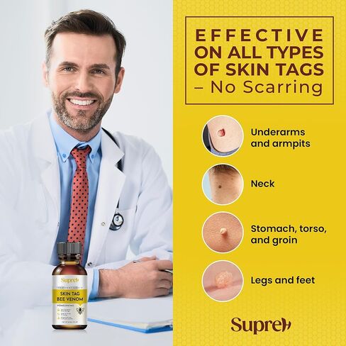 SupreH مزيل علامات الجلد الثؤلول سريع المفعول بسم النحل للرجال والنساء 10 in Kuwait