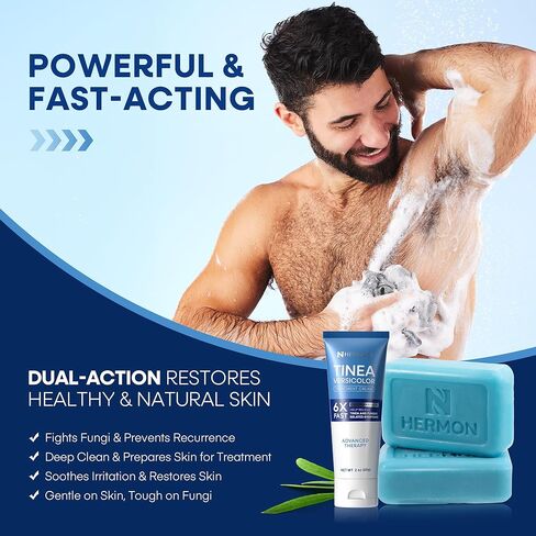 كريم وصابون علاج هيرمون سعفة المبرقشة: كريم مثبت سريريًا لقدم الرياضي، سعفة المبرقشة، حكة جوك، السعفة - يهدئ وينظف ويستعيد صحة البشرة in Kuwait