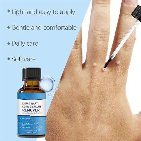 مصل احترافي لإزالة الثآليل والشامات - للوجه والجسم، تركيبة سريعة المفعول لجميع أنواع البشرة والرجال والنساء - 1 أونصة سائلة in Kuwait