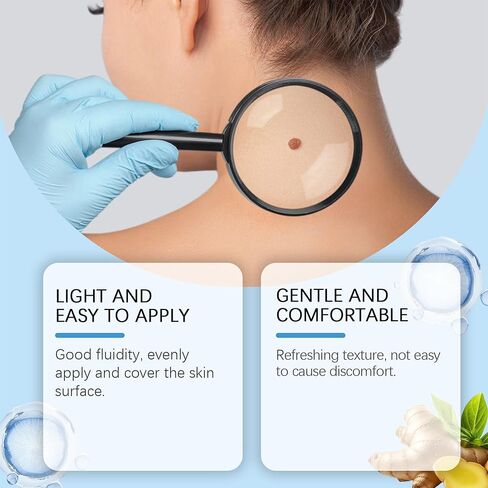 مصل احترافي لإزالة الثآليل والشامات - للوجه والجسم، تركيبة سريعة المفعول لجميع أنواع البشرة والرجال والنساء - 1 أونصة سائلة in Kuwait