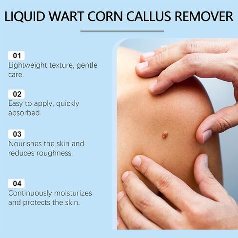 مصل احترافي لإزالة الثآليل والشامات - للوجه والجسم، تركيبة سريعة المفعول لجميع أنواع البشرة والرجال والنساء - 1 أونصة سائلة in Kuwait