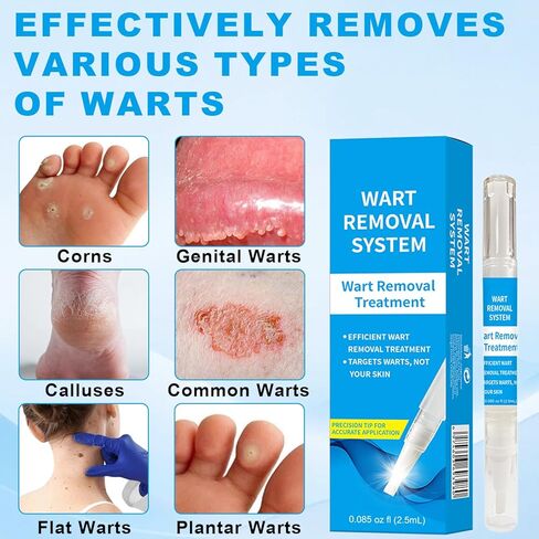 Fast Acting Skin Tag Remover for Face & Body - Salicylic Acid Mole and Wart Removal Pen with Brush I Gentle Formula for Wart Remover, Travel Size (0.085FL.OZ) in Kuwait