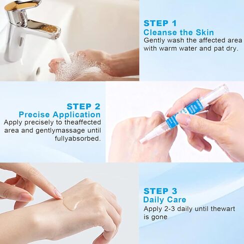 Fast Acting Skin Tag Remover for Face & Body - Salicylic Acid Mole and Wart Removal Pen with Brush I Gentle Formula for Wart Remover, Travel Size (0.085FL.OZ) in Kuwait